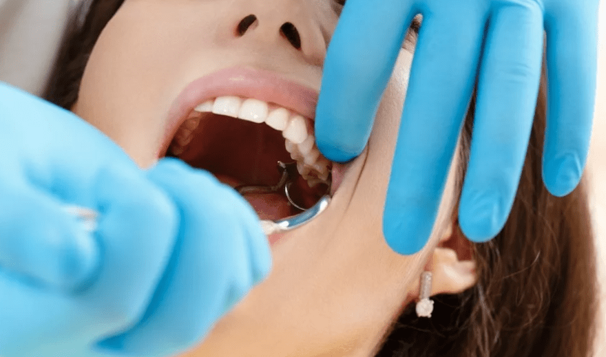 Удаление зубов в клинике